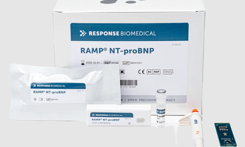 NT-proBNP Test